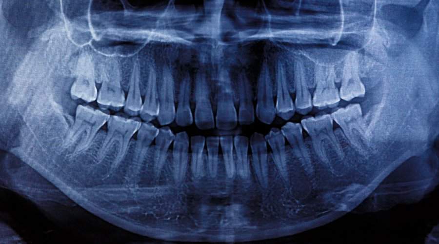 ¿Cuántos dientes tenemos y para qué sirven? - Estudi Dental Barcelona
