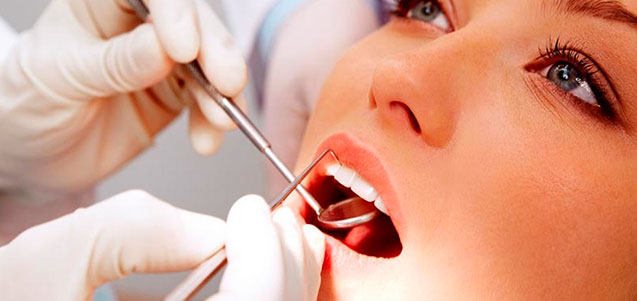 Tipos de Carillas dentales ¿Son para toda la vida?