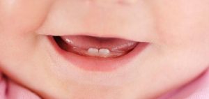 ¿Cuándo llevar a tu hijo al dentista por primera vez?