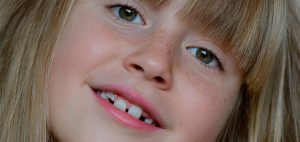 Cuando es recomendable la ortodoncia infantil