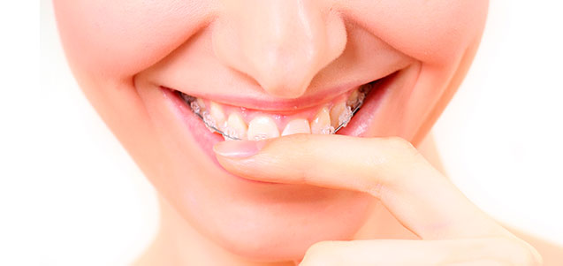 Principales objetivos de los tratamientos de ortodoncia