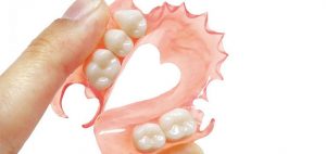 Tipos de prótesis dentales removibles
