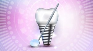 higiene implantes dentales