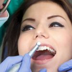 Carillas dentales provisionales