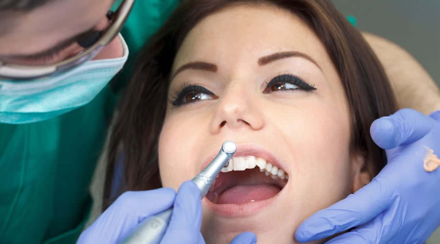 Carillas dentales provisionales