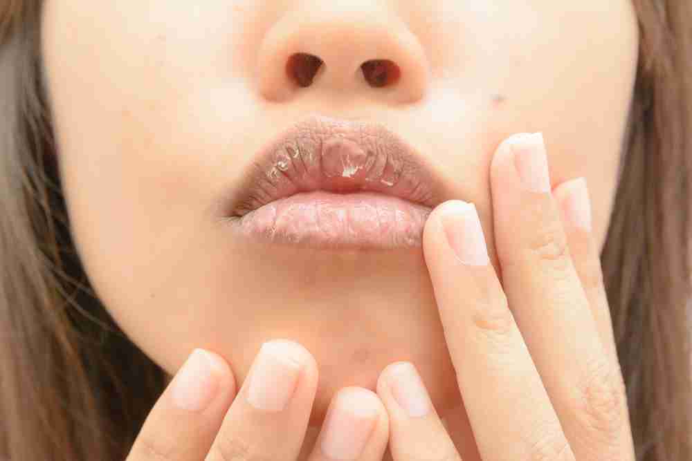 educación Tipo delantero Acercarse Qué es la xerostomía o sequedad en la boca y cómo solucionarla – Estudi  Dental Barcelona