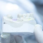 Encerado diagnostico estetica dental barcelona