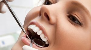 raspado radicular o curetaje y higiene dental