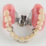 Protésis dentales y restauración provisional
