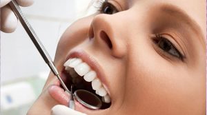 raspado radicular o curetaje y higiene dental