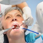 Señora mayor controlando sus implantes dentales