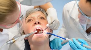 Señora mayor controlando sus implantes dentales