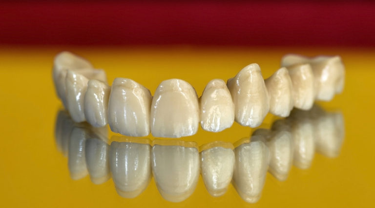 Puentes Dentales De Zirconio, ¿qué Son Y Cuándo Están Indicados ...