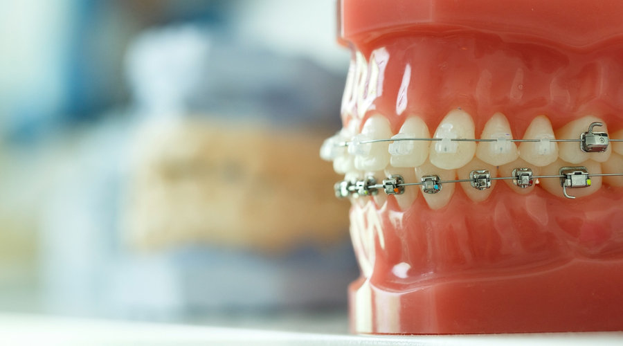 Historia de la ortodoncia – Estudi Dental Barcelona