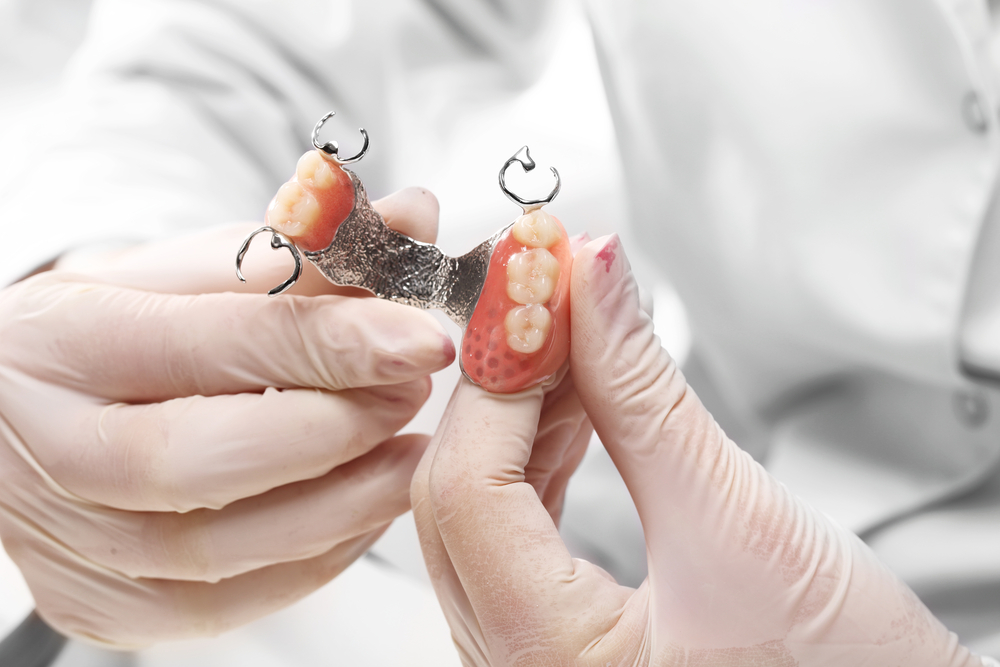 diente provisional de quita y pon