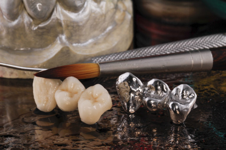 Coronas Dentales Estudi Dental Barcelona