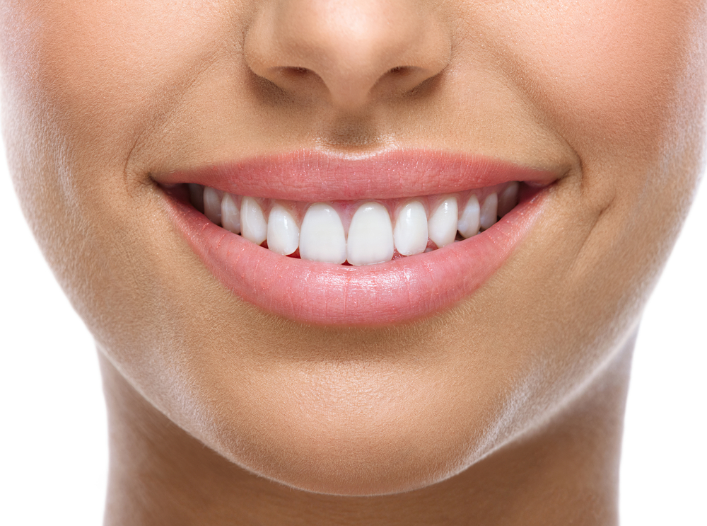 Carillas dentales: ¿cuáles son las ventajas y desventajas? – Estudi Dental  Barcelona