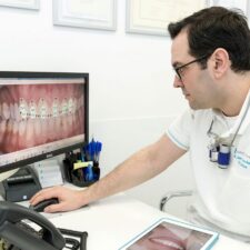 Mejor Clínica Dental En Barcelona. Tratamiento De Calidad | EDB