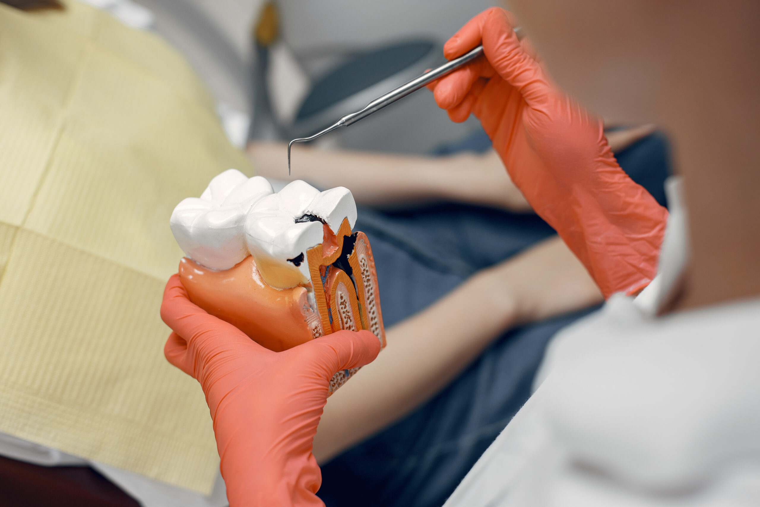 Dentista mostrando las raíces del diente