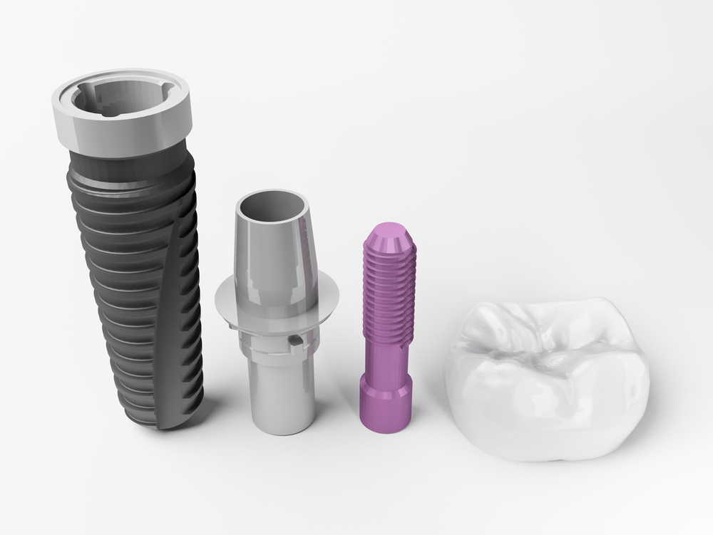 Dental implants Barcelona