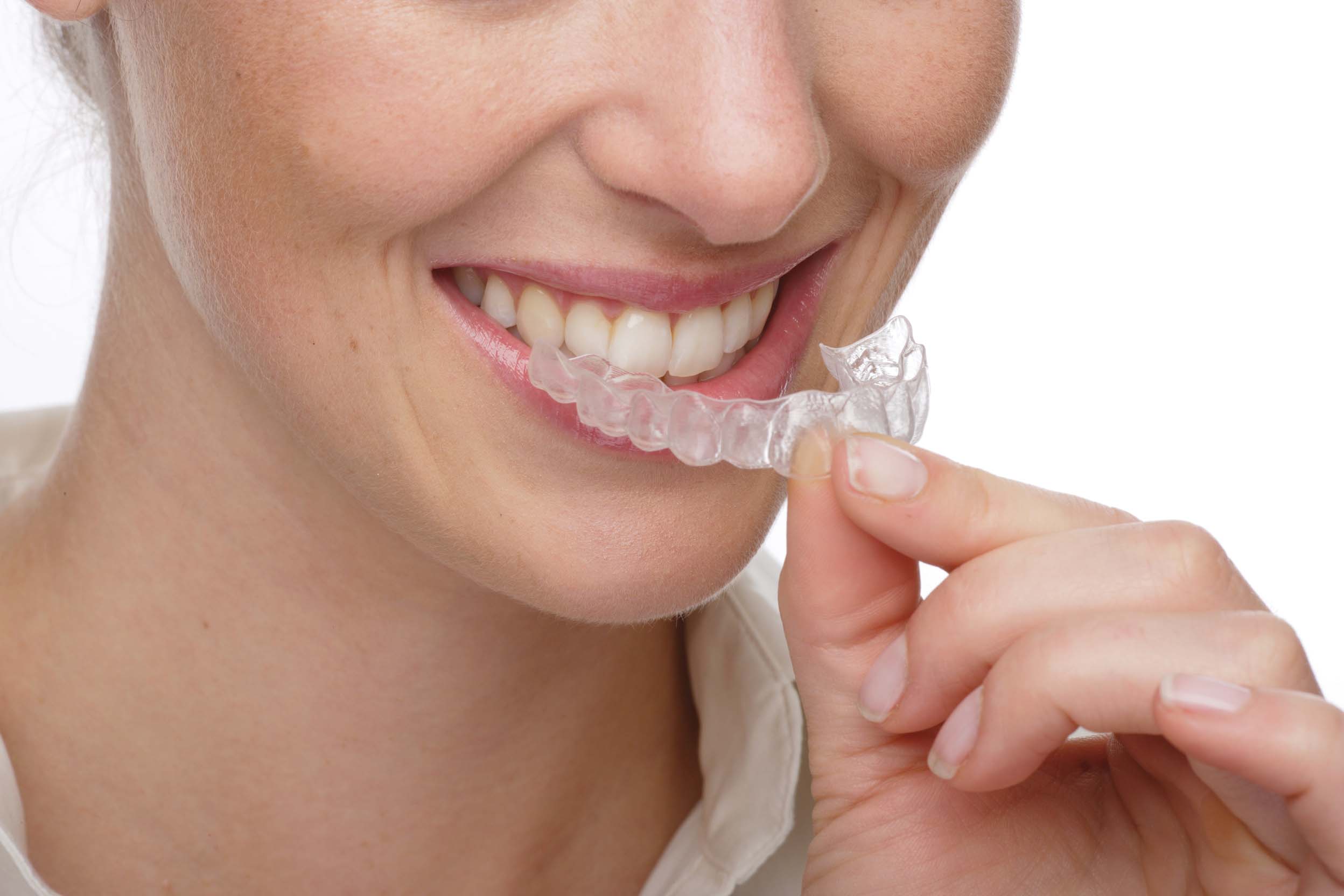 Ortodoncia invisible: Invisalign®