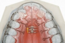 ortopedia funcional ortodoncia en Barcelona